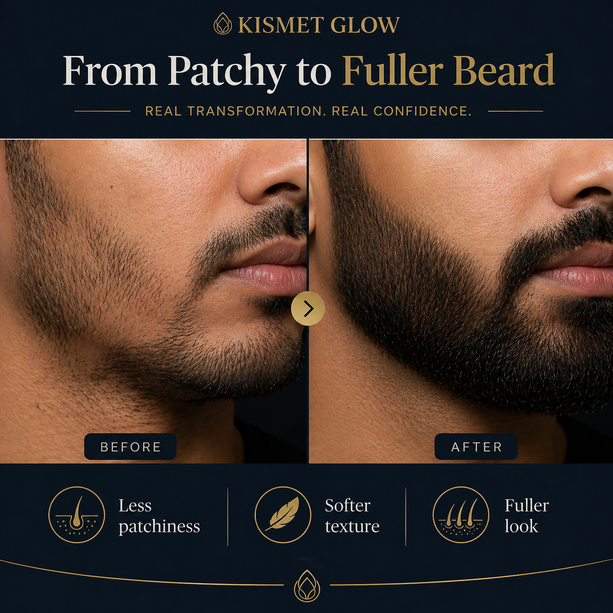 Beard Oil 30 ml | Rosemary, Almond & Tea Tree